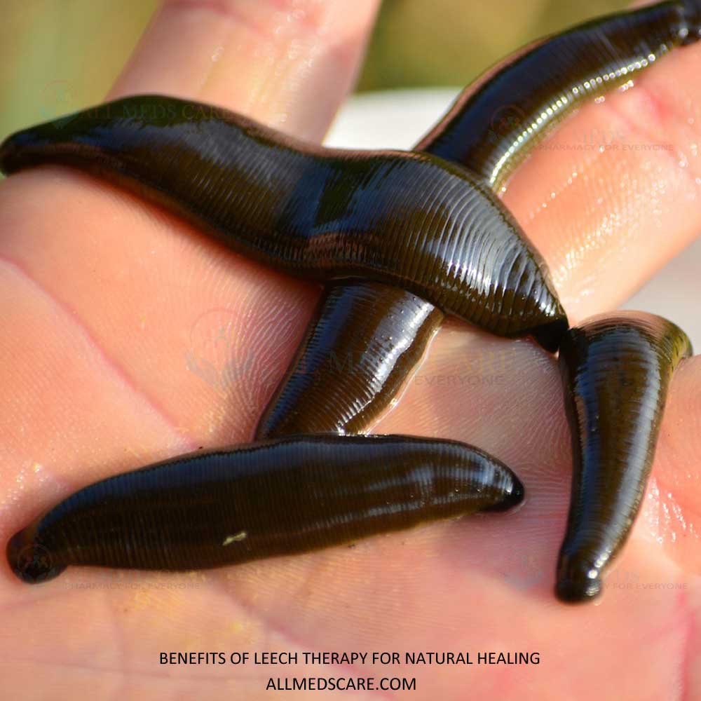 Discover the Benefits of Leech Therapy for Natural Healing